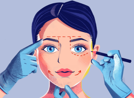 内外轮廓固定肿几天？术后3-5天消肿是常见情况！