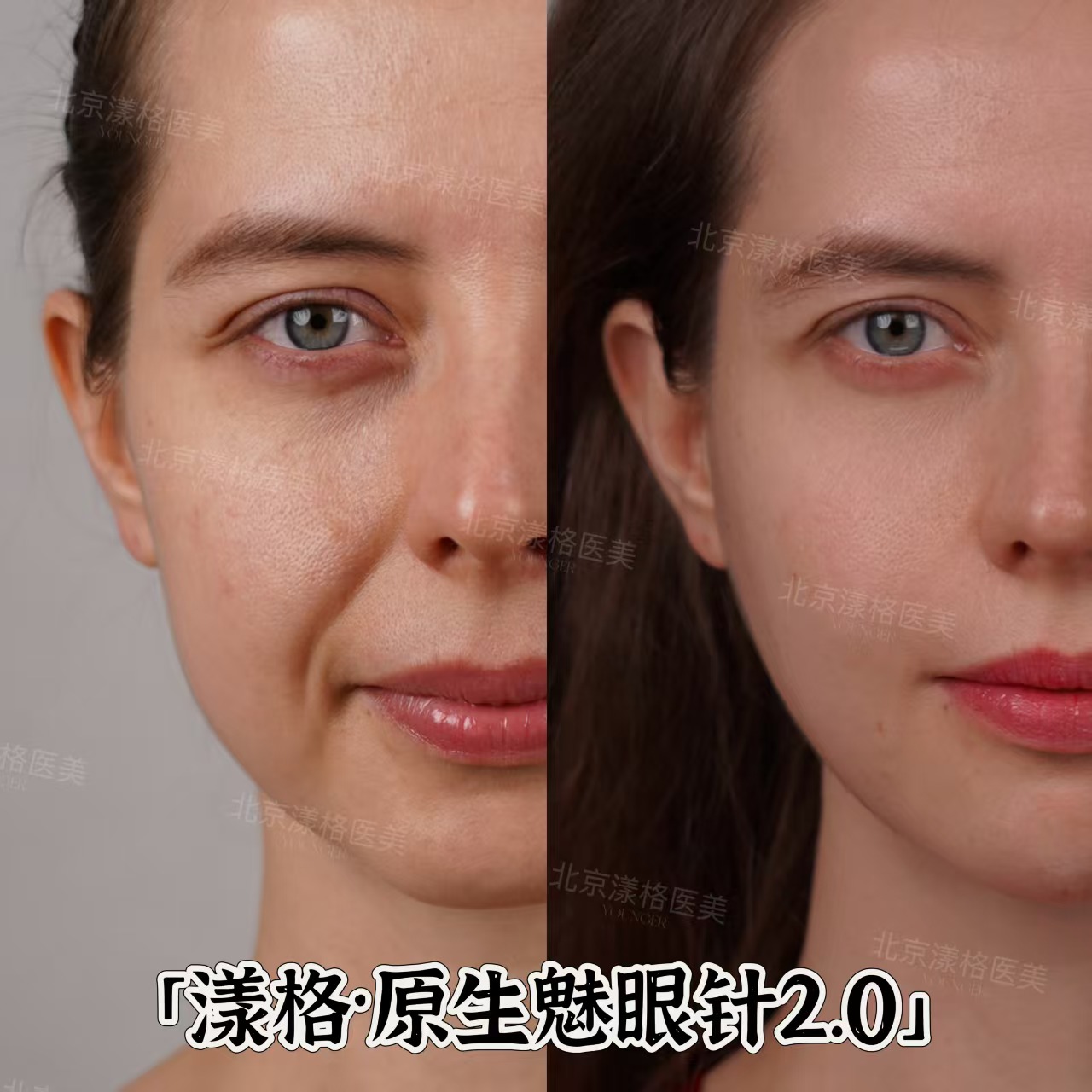 北京漾格李在郁靠谱吗？亲测靠谱！80%复购率+24个月长效维持+北大医学背景认证