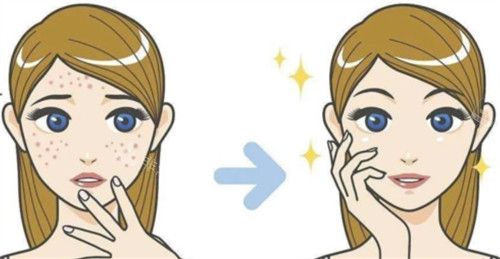 inmode钻石超塑多久做一次？专家推荐2-3个月一次效果更佳！