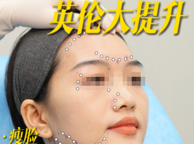 三、英伦大提升几天有成效:科学依据与术后建议