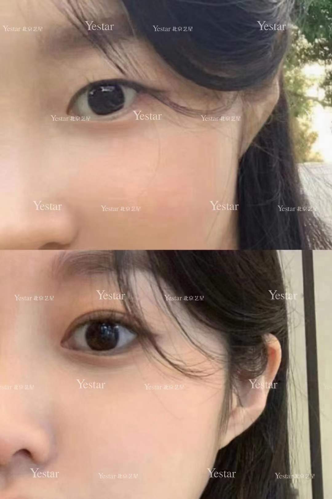 对比北京10家医院：伊妍仕真假辨别方法哪家扫码更便捷？