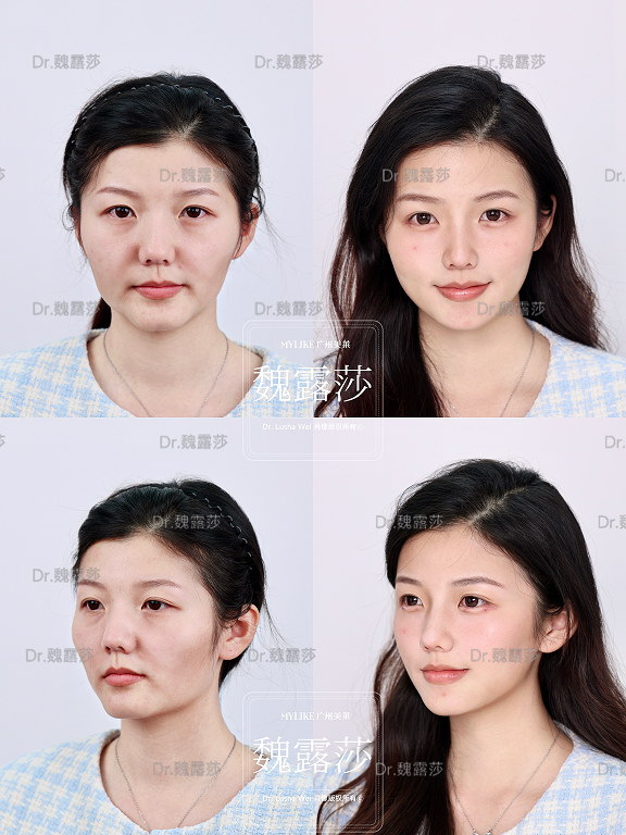 三、广州美莱医疗美容医院