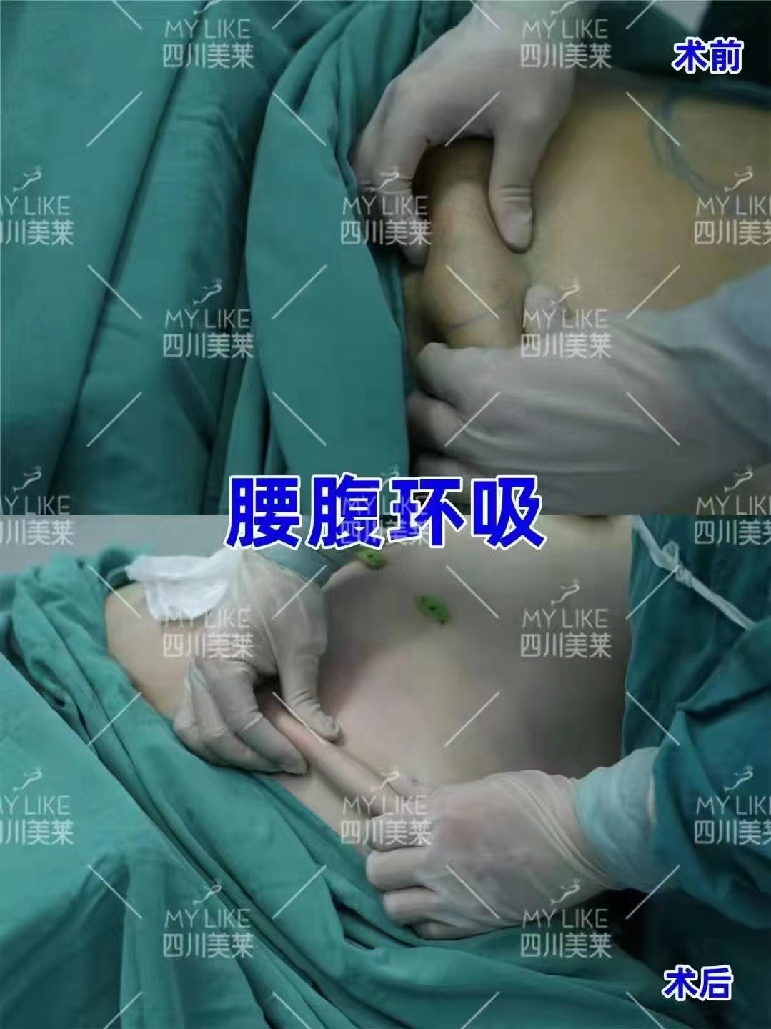 九、成都美莱医疗美容医院