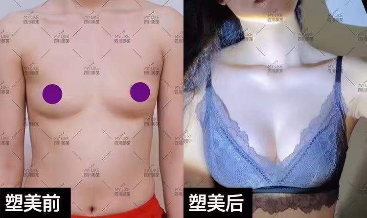 三、成都美莱整形医院