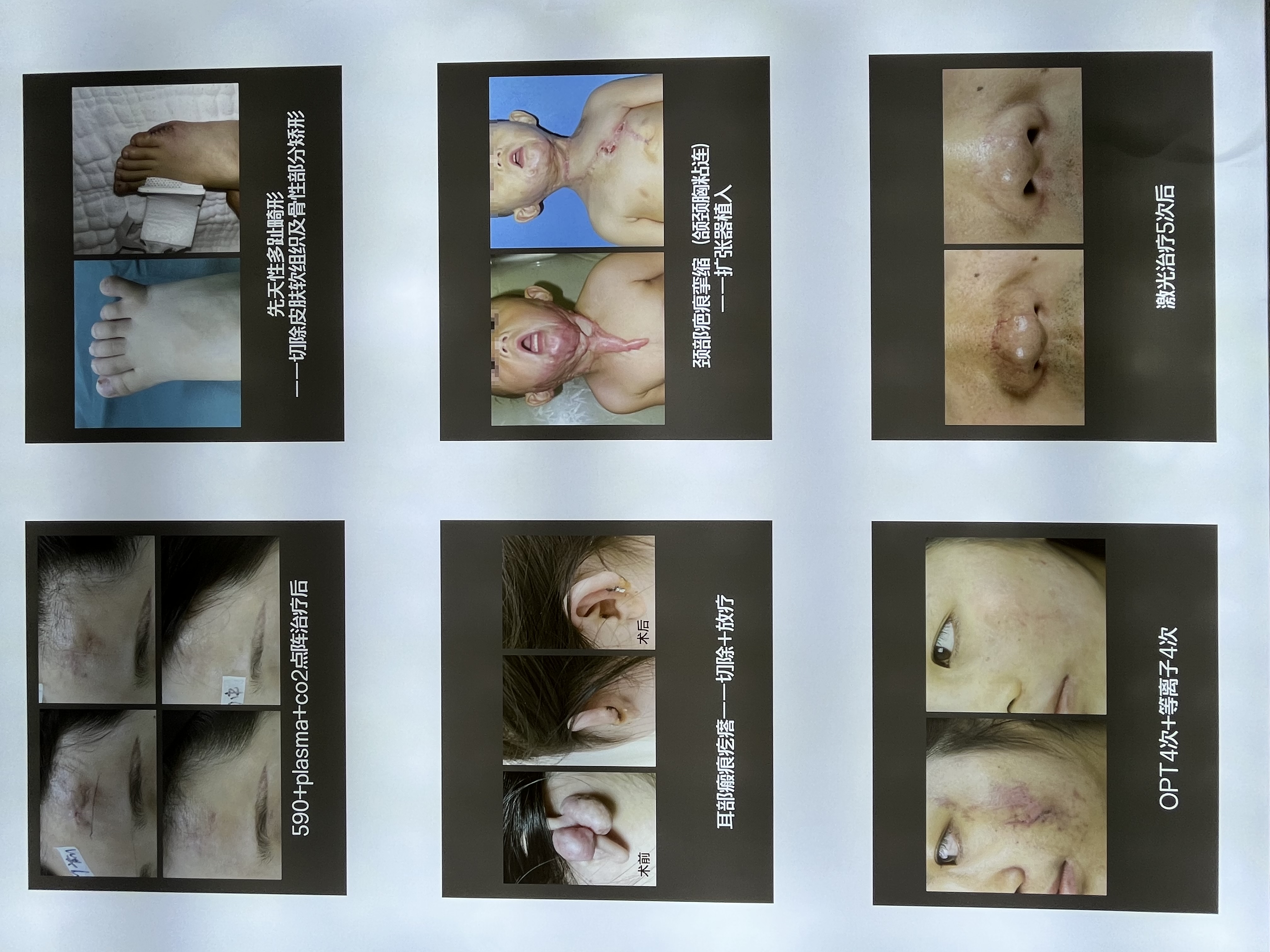 八、重庆华美整形医院