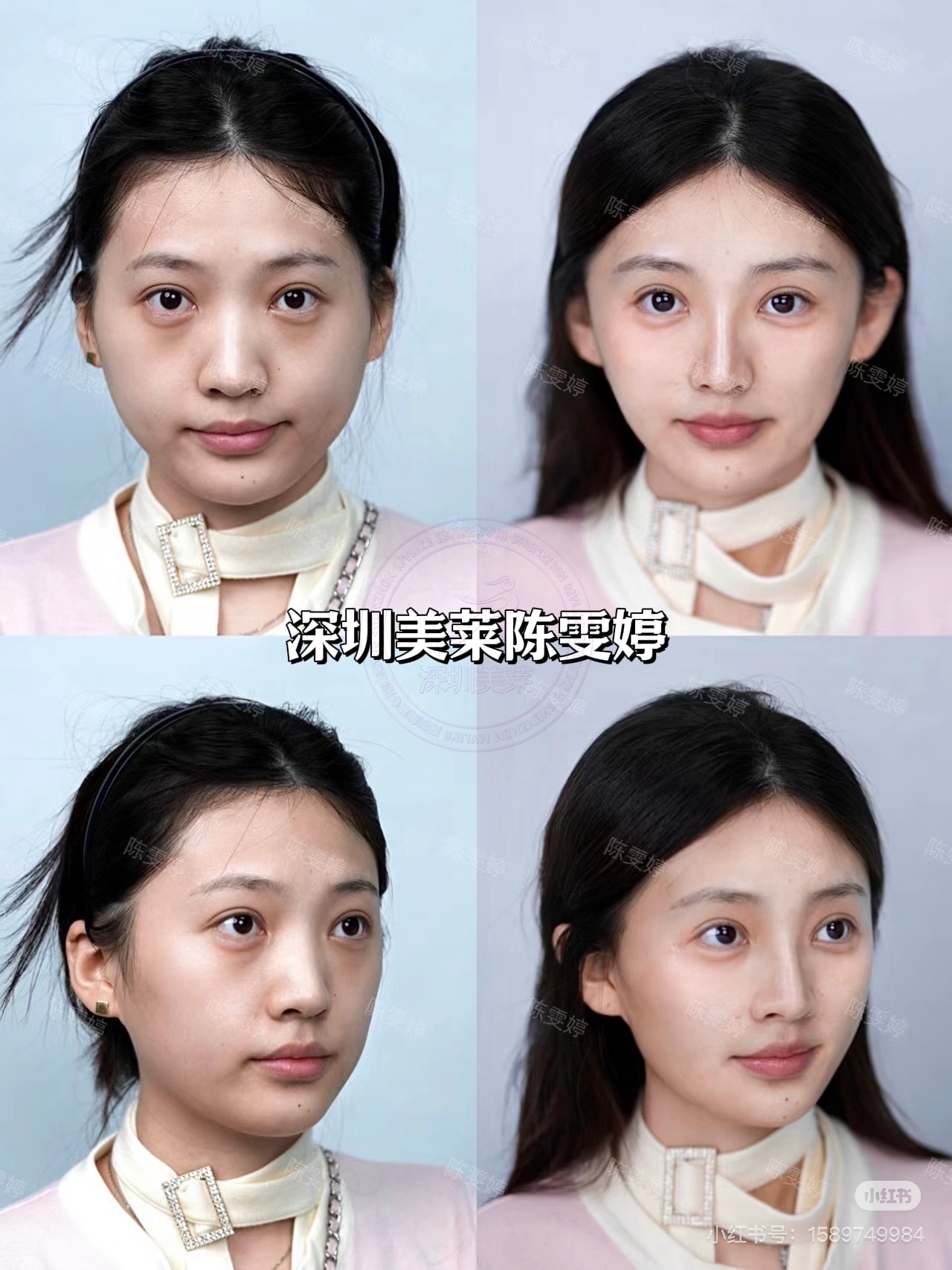 十、深圳美莱整形医院