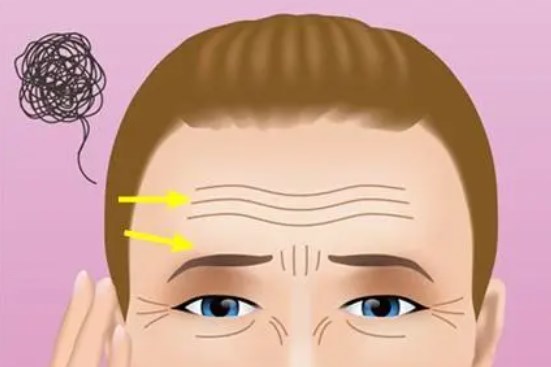 拉皮价格一览表：2026年主流技术价格分类及附加费用全解析	