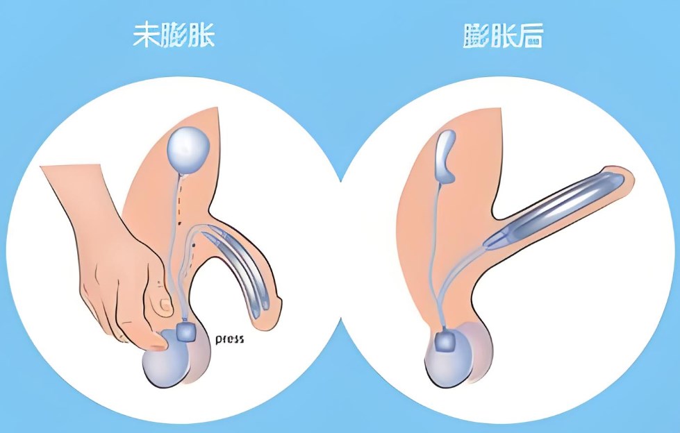三、如何延长骨雕鼻疗效｜科学维护是关键