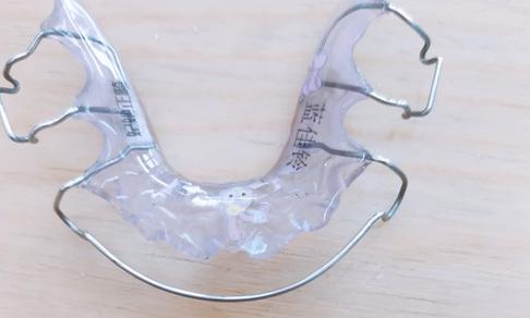 间隙保持器的种类有哪些？6大类型全解析，儿童选对才能有效维持！