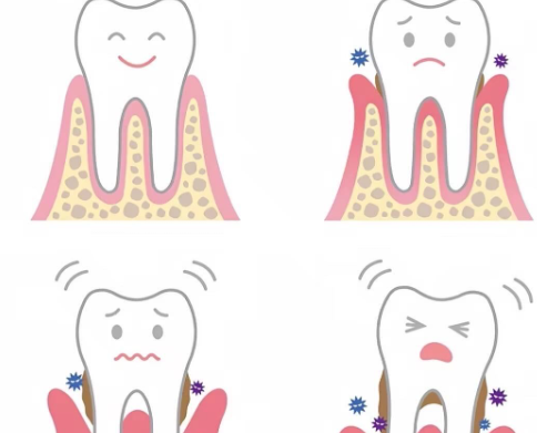 牙龈肉可以被轻轻扒开吗？别慌这些情况能恢复