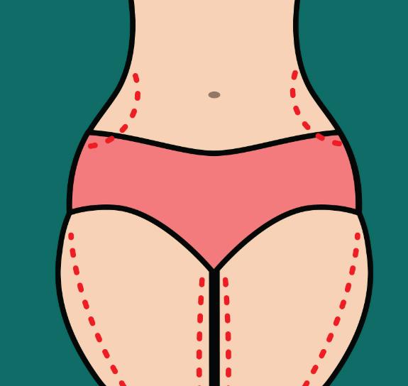 大腿吸脂能瘦多少厘米？真实用户反馈：吸脂2500ml瘦5cm左右的体验