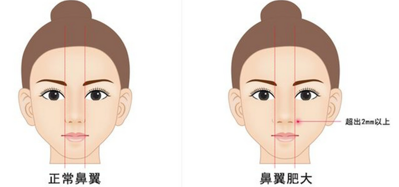 一、段焘医生做鼻子做得好吗？技术实力与口碑的全方面解析