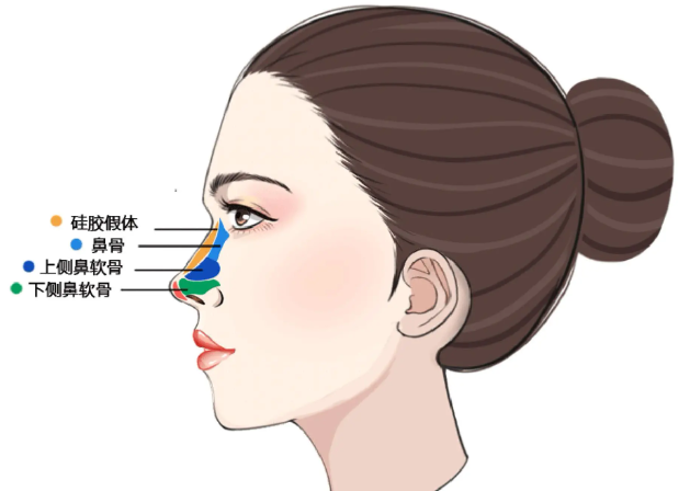 六、段焘肋骨隆鼻与其他材料的对比