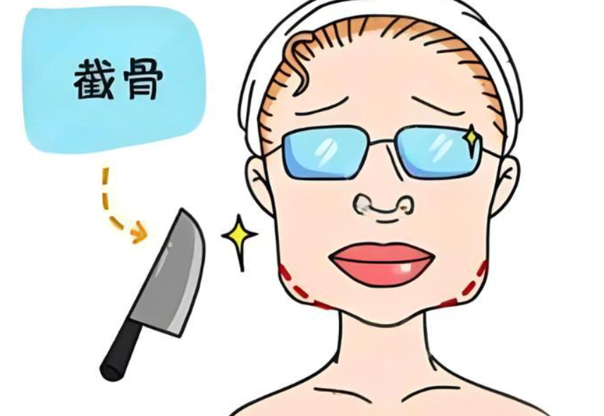 黄大勇磨骨医院正规吗？三级资质+四级认证！北京爱育华坐诊，价格3.8万起，技术靠谱案	