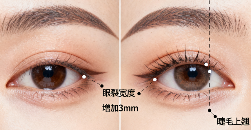 德州双眼皮哪家好医美2026推荐：天宏凯琳秦怡口碑好，公立医院全切6000-12000元起！	