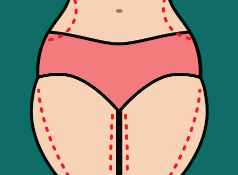 溶脂针艾尔菲琳混合注射效果能维持6-12个月