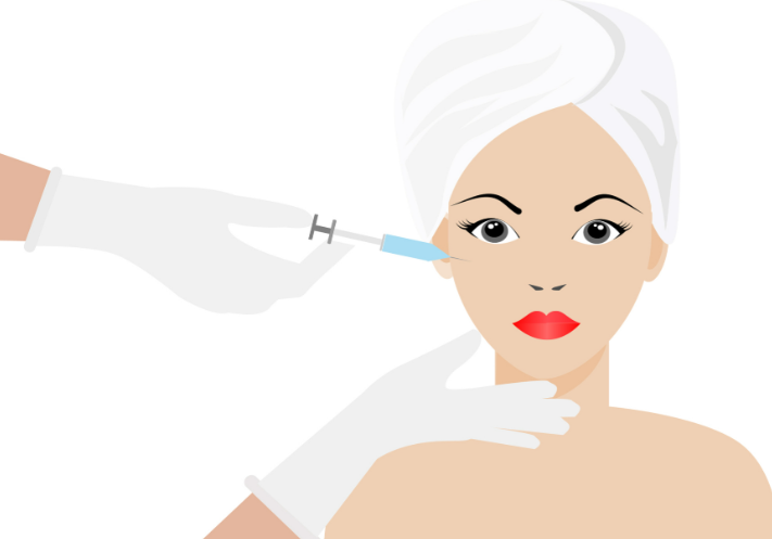 法令纹填充能维持多久？玻尿酸6-18个月看类型	