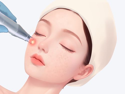 嘴角做了上扬手术起了疙瘩怎么办？术后3天消肿技巧+疤痕改善方案全解析！	