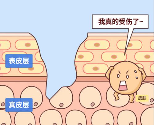 三、医学治疗：手段助力疤痕淡化