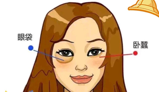 二、注射卧蚕的术后消肿周期与护理要点