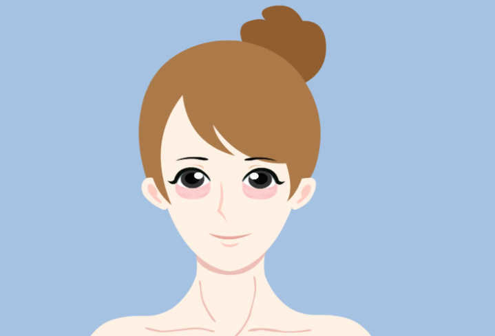 注射卧蚕多少钱？2026年热门城市报价+术后消肿周期科普！	